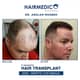 Slider image (9) Hairmedico